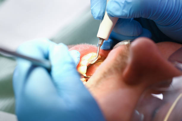 Best Emergency Tooth Extraction  in St Johns, AZ